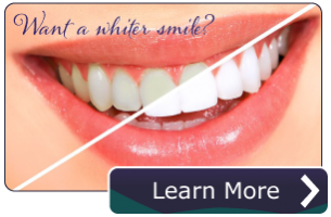 jacobson-teeth-whitening-CTA.png